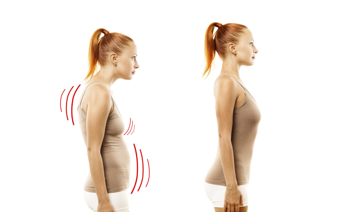 How Do You Improve Bad Posture?